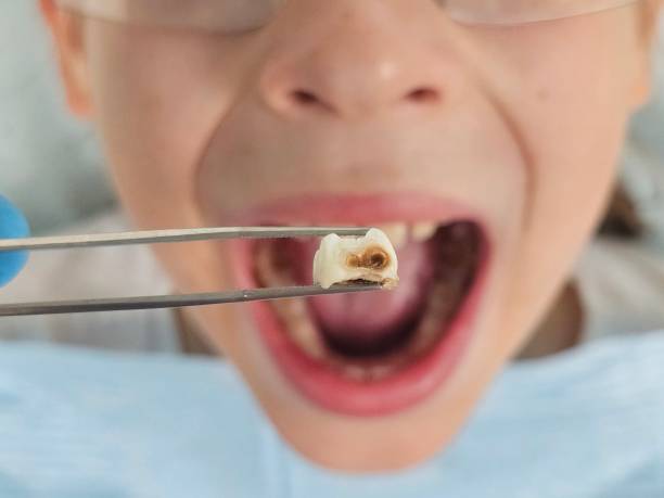 Professional Emergency Dental Service in TX